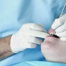 Crisi, l’allarme dei dentisti italiani: “Una famiglia su 3 non porta più i figli”