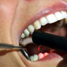 Un dentista su tre è abusivo